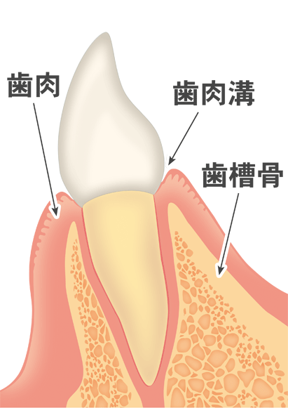 仙台市泉区の歯医者　明石台歯科医院　歯周病とは？　歯肉炎と歯周炎の違い