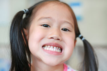小児の虫歯治療　Part２